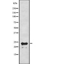 Western blot analysis of PLN using HeLa whole  lysates.