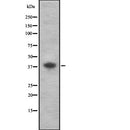 DF7910 at 1/100 staining Human Head and neck cancer tissue by IHC-P. The sample was formaldehyde fixed and a heat mediated antigen retrieval step in citrate buffer was performed. The sample was then blocked and incubated with the antibody for 1.5 hours at 22¡ãC. An HRP conjugated goat anti-rabbit antibody was used as the secondary