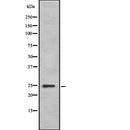 Western blot analysis of WARS using K562 whole  lysates.