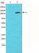 Western blot analysis on HepG2 cell lysate using HDAC9 Antibody,The lane on the left is treated with the antigen-specific peptide.