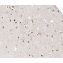 AF0181 at 1/100 staining human brain tissue sections by IHC-P. The tissue was formaldehyde fixed and a heat mediated antigen retrieval step in citrate buffer was performed. The tissue was then blocked and incubated with the antibody for 1.5 hours at 22¡ãC. An HRP conjugated goat anti-rabbit antibody was used as the secondary