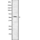 Western blot analysis of extracts from Mouse  kidney, using TMPRSS2 Antibody. The lane on the left was treated with blocking peptide.