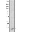 Western blot analysis of C17orf37 using K562 whole  lysates.