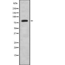 Western blot analysis of extracts from mouse brain, using SATB1 Antibody. Lane 1 was treated with the antigen-specific peptide.