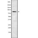 Western blot analysis of extracts from COS-7, using SCARF1 Antibody. The lane on the left was treated with blocking peptide.