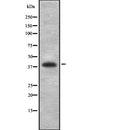 Western blot analysis of PCYT1A using K562 whole  lysates.
