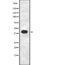 DF7928 at 1/100 staining Human liver cancer tissue by IHC-P. The sample was formaldehyde fixed and a heat mediated antigen retrieval step in citrate buffer was performed. The sample was then blocked and incubated with the antibody for 1.5 hours at 22¡ãC. An HRP conjugated goat anti-rabbit antibody was used as the secondary