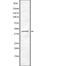 Western blot analysis of CKB using Jurkat whole  lysates.