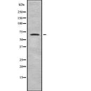 Western blot analysis of MSLN using MCF7 whole  lysates.