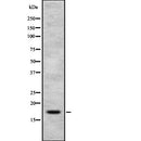 Western blot analysis of PIP using HepG2 whole  lysates.