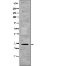 Western blot analysis of AICDA using COLO205 whole  lysates.