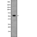 Western blot analysis of BACE1 using COLO205 whole  lysates.