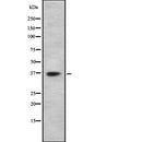 DF7947 staining Hela by IF/ICC. The sample were fixed with PFA and permeabilized in 0.1% Triton X-100,then blocked in 10% serum for 45 minutes at 25¡ãC. The primary antibody was diluted at 1/200 and incubated with the sample for 1 hour at 37¡ãC. An  Alexa Fluor 594 conjugated goat anti-rabbit IgG (H+L) Ab, diluted at 1/600, was used as the secondary antibod