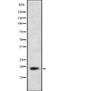 DF7950 staining HepG2 by IF/ICC. The sample were fixed with PFA and permeabilized in 0.1% Triton X-100,then blocked in 10% serum for 45 minutes at 25¡ãC. The primary antibody was diluted at 1/200 and incubated with the sample for 1 hour at 37¡ãC. An  Alexa Fluor 594 conjugated goat anti-rabbit IgG (H+L) Ab, diluted at 1/600, was used as the secondary antibod