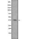 Western blot analysis of RRAGA using HepG2 whole  lysates.