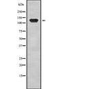 Western blot analysis of extracts from mouse brain, using TRPM8 Antibody.