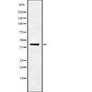 Western blot analysis of USP18 using Jurkat whole  lysates.