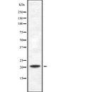 Western blot analysis of PDCD6 using K562 whole  lysates.