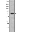 Western blot analysis of RGS9 using K562 whole  lysates.