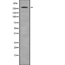 Western blot analysis of ACACB using MCF7 whole  lysates.