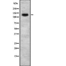 DF7982 at 1/100 staining Mouse kidney tissue by IHC-P. The sample was formaldehyde fixed and a heat mediated antigen retrieval step in citrate buffer was performed. The sample was then blocked and incubated with the antibody for 1.5 hours at 22¡ãC. An HRP conjugated goat anti-rabbit antibody was used as the secondary