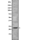 Western blot analysis of MXD3 using Jurkat whole  lysates.