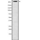 Western blot analysis of MUC16 using NIH-3T3 whole  lysates.
