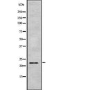 Western blot analysis of ARFRP1 using Jurkat whole  lysates.