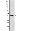 Western blot analysis of CAB39 using HepG2 whole  lysates.