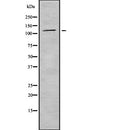 DF7993 staining HepG2 by IF/ICC. The sample were fixed with PFA and permeabilized in 0.1% Triton X-100,then blocked in 10% serum for 45 minutes at 25¡ãC. The primary antibody was diluted at 1/200 and incubated with the sample for 1 hour at 37¡ãC. An  Alexa Fluor 594 conjugated goat anti-rabbit IgG (H+L) Ab, diluted at 1/600, was used as the secondary antibod