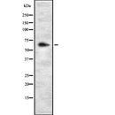 DF7997 at 1/100 staining Human kidney tissue by IHC-P. The sample was formaldehyde fixed and a heat mediated antigen retrieval step in citrate buffer was performed. The sample was then blocked and incubated with the antibody for 1.5 hours at 22¡ãC. An HRP conjugated goat anti-rabbit antibody was used as the secondary