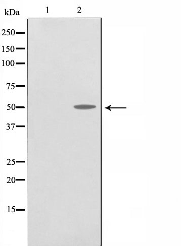 AF0827 staining A-431 cells by IF/ICC. The sample were fixed with PFA and permeabilized in 0.1% Triton X-100,then blocked in 10% serum for 45 minutes at 25¡ãC. The primary antibody was diluted at 1/200 and incubated with the sample for 1 hour at 37¡ãC. An  Alexa Fluor 594 conjugated goat anti-rabbit IgG (H+L) antibody(Cat.