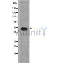 DF8008 at 1/100 staining Mouse kidney tissue by IHC-P. The sample was formaldehyde fixed and a heat mediated antigen retrieval step in citrate buffer was performed. The sample was then blocked and incubated with the antibody for 1.5 hours at 22¡ãC. An HRP conjugated goat anti-rabbit antibody was used as the secondary