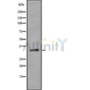 Western blot analysis of extracts from various samples, using PSMD14 Antibody.
 Lane 1: Rat  lung, treated with blocking peptide;
 Lane 2: Rat  lung;
 Lane 3: B16F10.