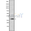 Western blot analysis of extracts from Mouse liver, using CALB1 Antibody. The lane on the left was treated with blocking peptide.