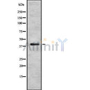 Western blot analysis SOX18 using Jurkat whole cell lysates