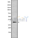 Western blot analysis SMN1 using Jurkat whole cell lysates