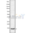 Western blot analysis of TNFRSF12A using COLO205 whole cell lysates