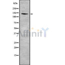 Western blot analysis of RASGRF1 using Jurkat whole cell lysates