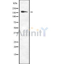DF8030 at 1/100 staining Mouse colon tissue by IHC-P. The sample was formaldehyde fixed and a heat mediated antigen retrieval step in citrate buffer was performed. The sample was then blocked and incubated with the antibody for 1.5 hours at 22¡ãC. An HRP conjugated goat anti-rabbit antibody was used as the secondary