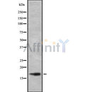 Western blot analysis UBE2L3 using mouse brain lysates