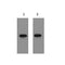 1ug KT3 fusion protein+ Primary antibody dilution at 1?1:5,000 2?1:10,000