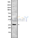 Western blot analysis of CD81 using K562 whole cell lysates