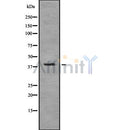 DF8046 staining  HuvEc cells by IF/ICC. The sample were fixed with PFA and permeabilized in 0.1% Triton X-100,then blocked in 10% serum for 45 minutes at 25¡ãC. The primary antibody was diluted at 1/200 and incubated with the sample for 1 hour at 37¡ãC. An  Alexa Fluor 594 conjugated goat anti-rabbit IgG (H+L) antibody(Cat.