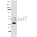 Western blot analysis NEUROG2 using HeLa whole cell lysates