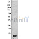 DF8054 at 1/100 staining Human Melanoma tissue by IHC-P. The sample was formaldehyde fixed and a heat mediated antigen retrieval step in citrate buffer was performed. The sample was then blocked and incubated with the antibody for 1.5 hours at 22¡ãC. An HRP conjugated goat anti-rabbit antibody was used as the secondary