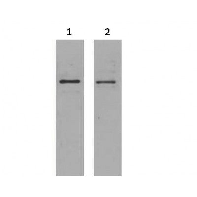 2ug S-Tag fusion protein+ Primary antibody dilution at 1?1:5,000 2?1:10,000