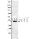 DF8057 staining Hela by IF/ICC. The sample were fixed with PFA and permeabilized in 0.1% Triton X-100,then blocked in 10% serum for 45 minutes at 25¡ãC. The primary antibody was diluted at 1/200 and incubated with the sample for 1 hour at 37¡ãC. An  Alexa Fluor 594 conjugated goat anti-rabbit IgG (H+L) Ab, diluted at 1/600, was used as the secondary antibod