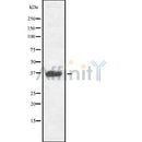 DF8066 staining  Hela cells by IF/ICC. The sample were fixed with PFA and permeabilized in 0.1% Triton X-100,then blocked in 10% serum for 45 minutes at 25¡ãC. The primary antibody was diluted at 1/200 and incubated with the sample for 1 hour at 37¡ãC. An  Alexa Fluor 594 conjugated goat anti-rabbit IgG (H+L) antibody(Cat.