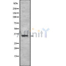 DF8068 at 1/100 staining Human lung tissue by IHC-P. The sample was formaldehyde fixed and a heat mediated antigen retrieval step in citrate buffer was performed. The sample was then blocked and incubated with the antibody for 1.5 hours at 22¡ãC. An HRP conjugated goat anti-rabbit antibody was used as the secondary